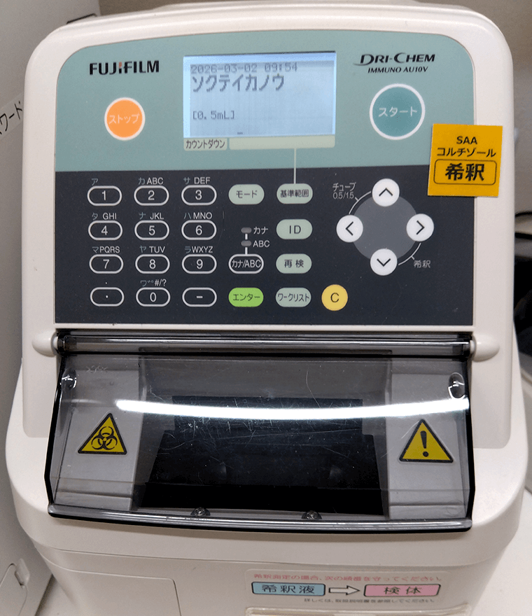 免疫反応測定装置